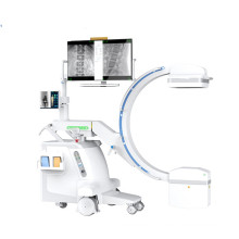 Mobile Digital FPD C-arm System Raidography X ray Lumbar Vertebra Fluoroscopy PLX118C